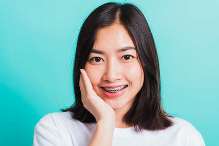 Portrait of Asian teen beautiful young woman smile have dental braces on teeth laughing she touching her face by hand, studio shot isolated on a blue background, Medicine and dentistry conceptの写真素材