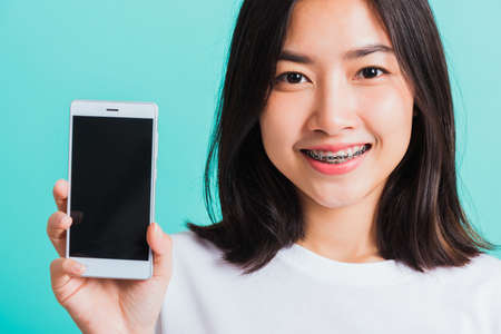 Portrait of Asian teen beautiful young woman smile have dental braces on teeth laughing she hold and show smart mobile phone blank screen, isolated on blue background, Medicine and dentistry conceptの写真素材