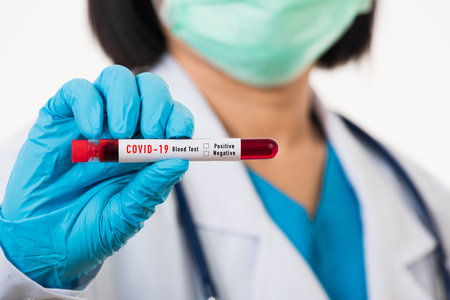 Doctor scientist in white uniform wear a mask holding test tube Coronavirus test blood sample in a clinical laboratory for analyzing isolated on white, medicine COVID-19 pandemic outbreak conceptの写真素材