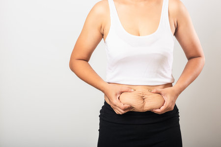 Close up of Asian mother woman showing stretch mark loose lower abdomen skin she fat after pregnancy baby birth, studio isolated on white background, Healthy belly overweight excess body conceptの写真素材