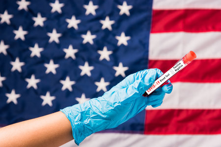 Hands of doctor wearing gloves holding blood test tube coronavirus (COVID-19) virus in the laboratory on flag United States of America background, USA Vaccinationの写真素材