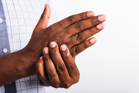 Closeup hand Asian black man holds his palm hand injury, feeling pain, studio shot isolated on white background. Health care and medical office syndrome conceptの写真素材