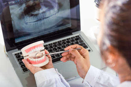 Oral dental hygiene. Dentist healthy white tooth model and explorer mirror tool instrument in dentist explaining to patient at clinic office and teeth X-ray on laptop screen, dental healthcare conceptの写真素材