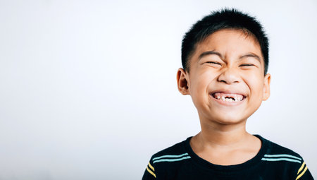 Schoolboy grins upper tooth lost gap shown in smile. Child dental care isolated on white. Joyful...