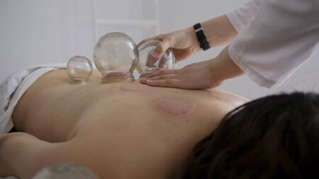 Doctor removes a medical glass cup on the back of a womanの写真素材