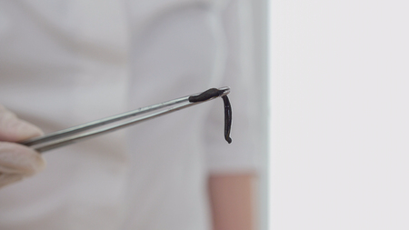 Doctor holding leech in tweezers - close upの写真素材