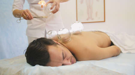 Alternative Asian Tibetan medicine, treatment using glass jarsの写真素材