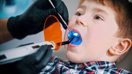 A little boy having his tooth done in the dentistry - putting the photopolymer lamp with blue light in the mouth to set the sealの写真素材
