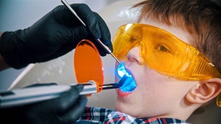 A little boy having his tooth done in the clinic - putting the photopolymer lamp in the mouthの写真素材