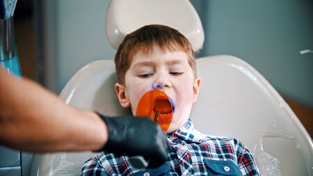 A little boy having his tooth done - putting the photopolymer lamp in the mouthの写真素材