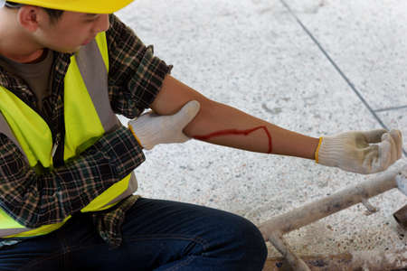 Injury bleeding from work accident in pile of scaffolding steel falling down to impinge the arm of young builder.の写真素材