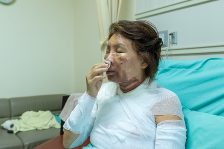 Nursing care and treatment for patient at burn unit in hospital.の写真素材