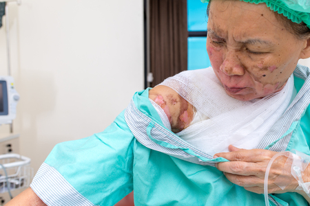 Nursing care and treatment for patient at burn unit in hospital.の写真素材