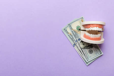 Closeup model of a human jaw with white teeth and dollar bill. Dentistry conceptual photo. Prosthetic dentistry. False teet top view with copy space.の写真素材
