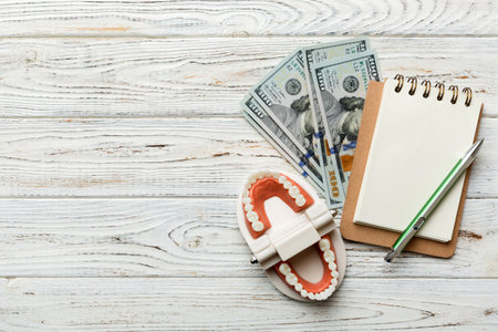 Flat lay composition with educational dental typodont model and money with notebook on colored table, top view. Expensive treatment.の写真素材