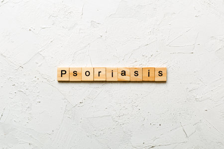 Psoriasis word written on wood block. Psoriasis text on table, concept.の写真素材