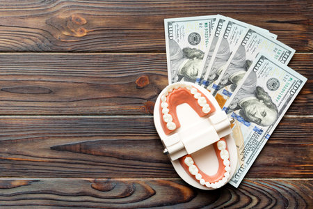 Closeup model of a human jaw with white teeth and dollar bill. Dentistry conceptual photo....