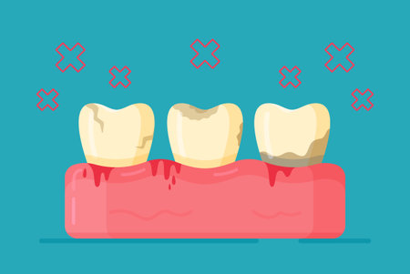 Vector illustration of dental diseases. The concept of inflamed teeth. Sore teeth. Unbrushed teeth. Not hygienic. Going to the dentist.のイラスト素材