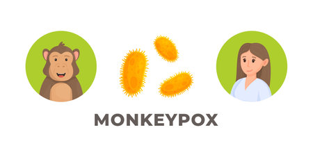 Monkeypox outbreak in 2022. Vector illustration of the virus spreading in Spain and Africa. Direct physical contact.のイラスト素材