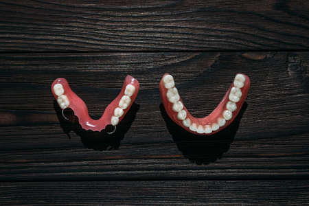Dentures on a dark background. Close-up of dentures. Removable plastic jaw prosthesis. Prosthetic...