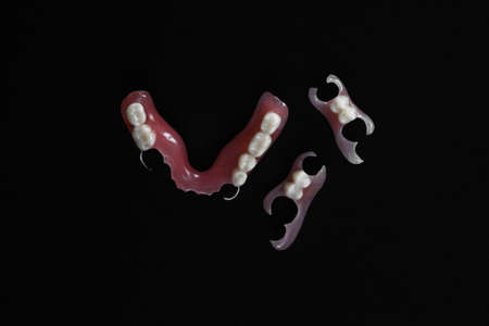 Dentures on a black background. Close-up of dentures. Dentistry is conceptual photography. Prosthetic dentistry. False teeth. Prosthetics. Close-up of plastic dentures. Teeth on a black backgroundの写真素材