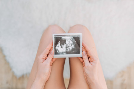 Pregnant woman looking at ultrasound scan of baby, close up of scan. Pregnant woman holding...