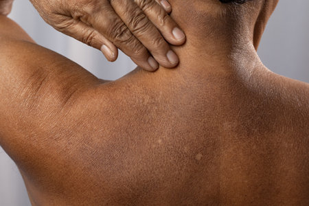 Close up of an Indian man showing white and black scars on his skin, healthcare concept