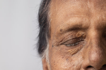 Close up of white bags an wrinkles around eye of an Indian old man on white backgroundの写真素材