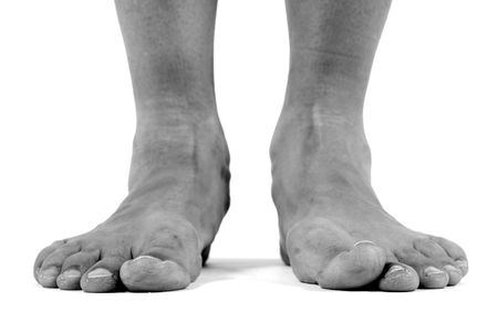 black and white image of flat feet  の写真素材