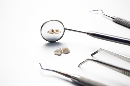Dental tools and remove teeth at clinic on whiteの写真素材