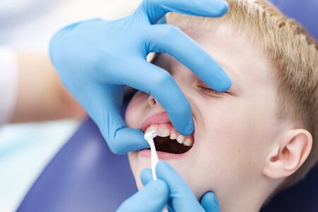Male dentist examines the teeth of the patient cheerful child with blond hair. Boy smiling in dentists chair with mouth wide open.の写真素材
