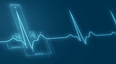 cardiogram