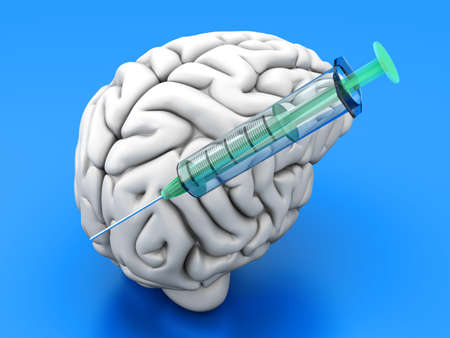 Syringes injecting substances into a human brain の写真素材