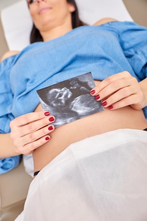 A young pregnant woman shows her ultrasound picture in the clinic.