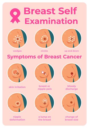 Breast cancer exam. Infographic of oncology tumor symptoms, cartoon young girl self examination. Vector diagnosis instructions to inspection woman mammographyのイラスト素材
