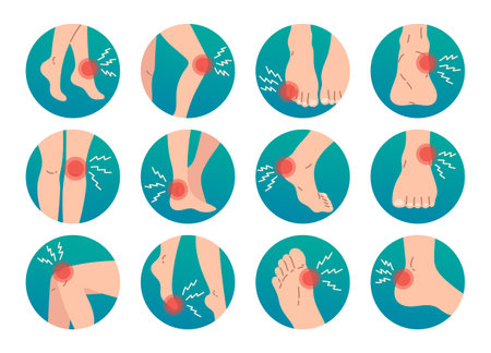 Leg pain and injury vector icon set in circleのイラスト素材