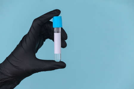 Hand in medical gloves holds a test tube on a blue backgroundの写真素材