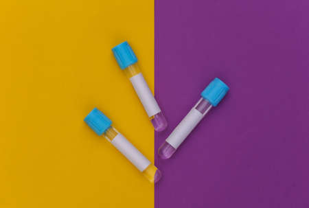 Medical test tubes on purple yellow background. top viewの写真素材
