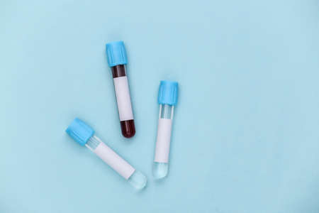 blood test. Test tubes on blue background. top view