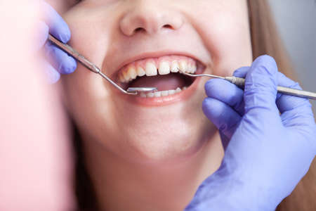 Close-up woman smiling on checkup at dentist in dental clinic