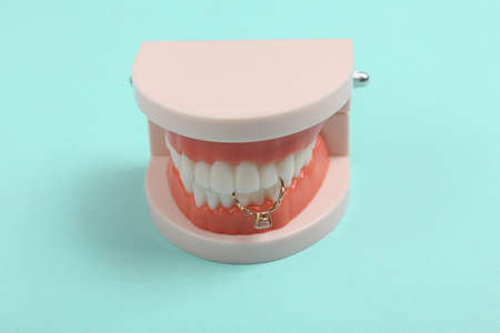 Plastic model of human jaw with golden ring in the teeth on blue background. Marriage proposal