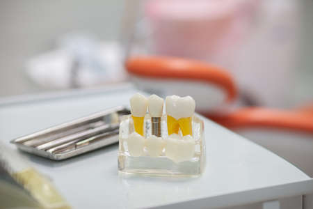 Dental implant model and dental instruments on the table in the dental office