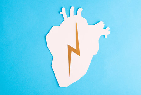 heart attack. Paper cut anatomical heart with lightning on blue backgroundの写真素材