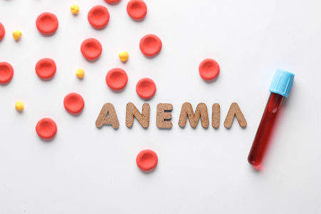 Red blood cells model and word anemia, test tube on white background. Medicine and healthcareの写真素材