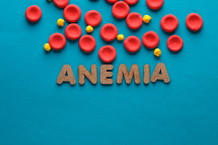 Red blood cells model and word anemia on blue background. Blood diseaseの写真素材