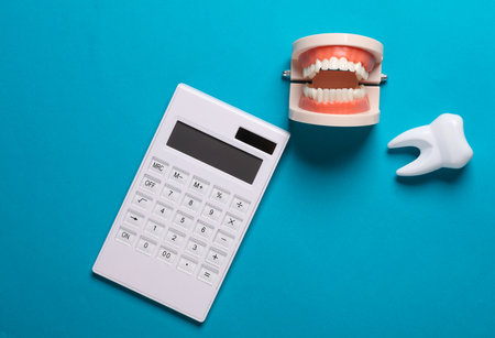 Calculator with jaw and tooth model on a blue background. The cost of dental treatment