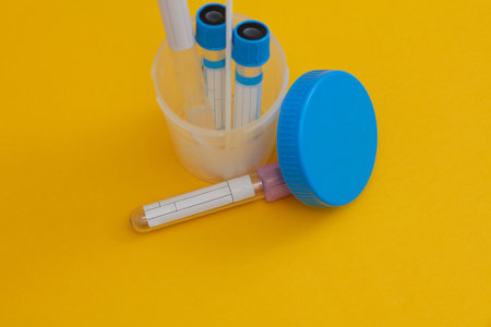 Medical test tubes and jar for tests on yellow backgroundの写真素材