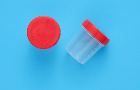 Urine test jar on a blue background