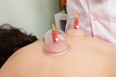 description: Tibetan medicine vacuum therapy acupuncture