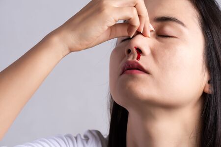 Nosebleed , a young woman with a bloody nose. Healthcare and medical concept.